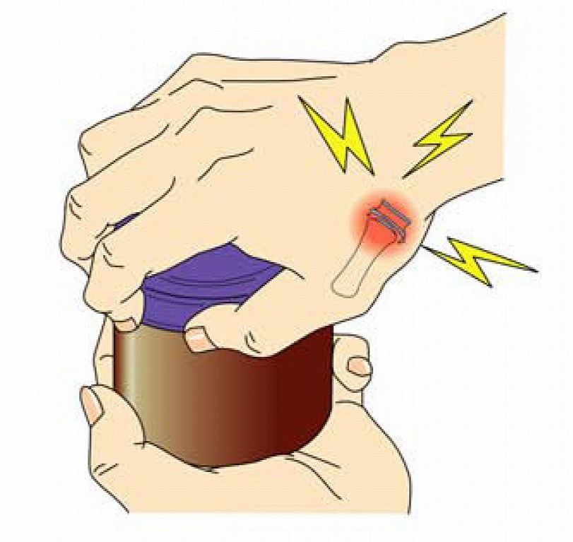 親指 の 付け根 の 痛み